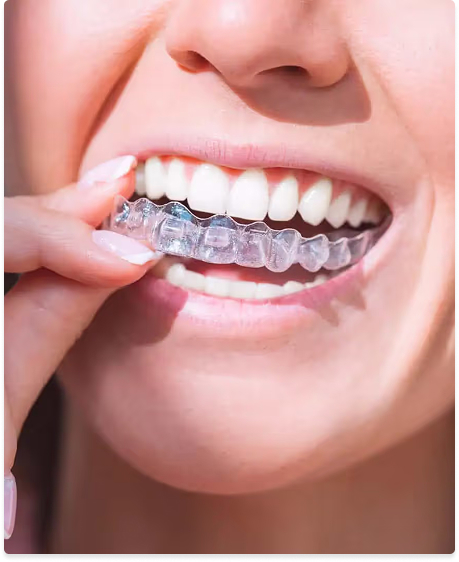 Clear aligners at Kennedy Dental Care